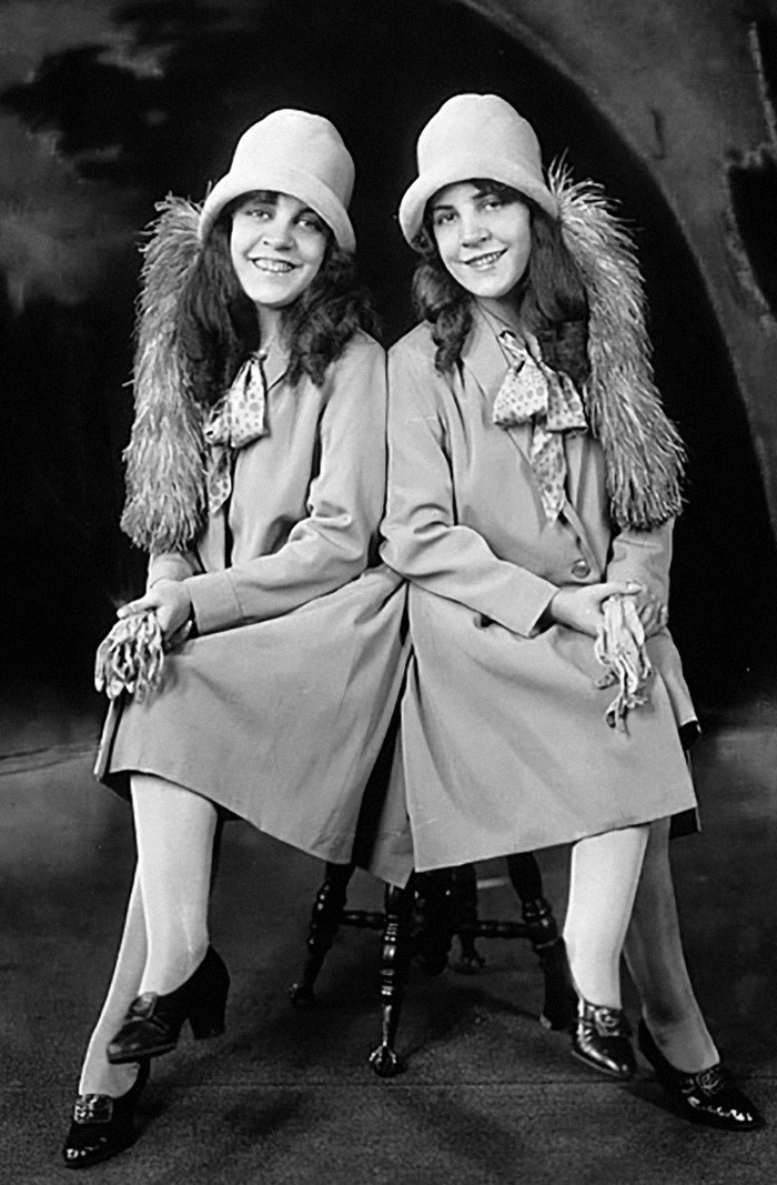 People Learn Harrowing Story Of Conjoined Twins, Which Ended With One Alive And The Other Not - 2