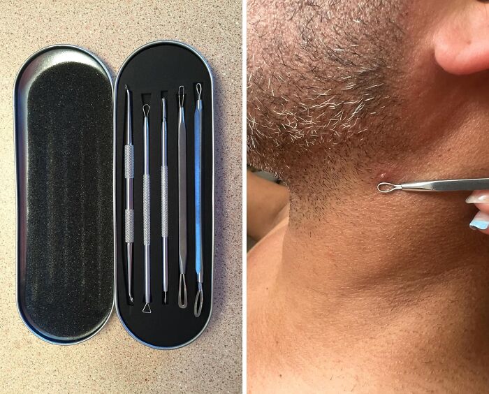 Experience Clearer Skin With The Pimple Popper Tool Kit: Your Set For Blemish-Free Complexion