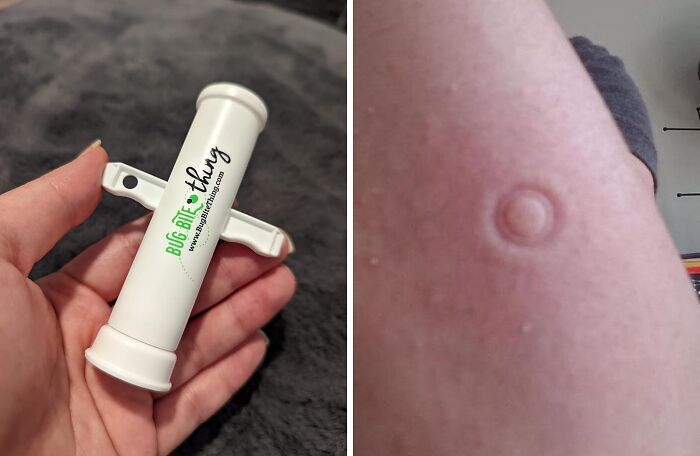 Soothe Away Irritation With Natural Insect Bite Relief: Your Go-To Remedy For Outdoor Comfort