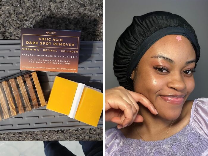 Achieve Radiant Skin With Dark Spot Remover Soap Bars: Solution For Even Complexion