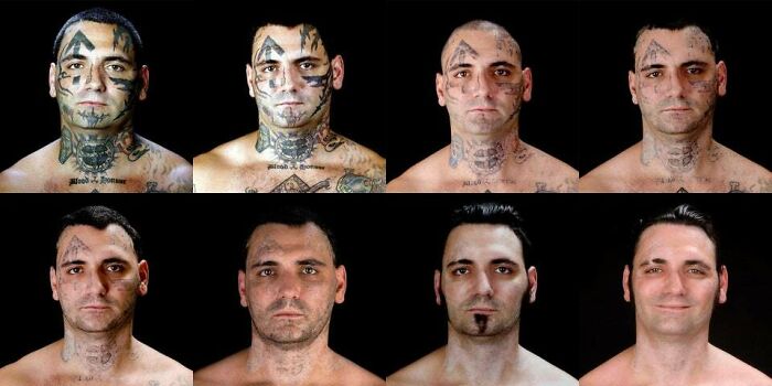 Ex-Skinhead Gets His Racist Tattoos Removed After Becoming A Dad