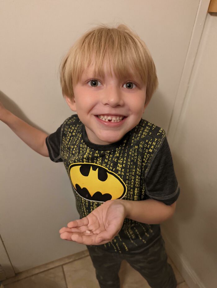 I Don't Have A Lot Of Friends But I Really Want To Tell Someone. My Little Guy Lost His First Tooth!
