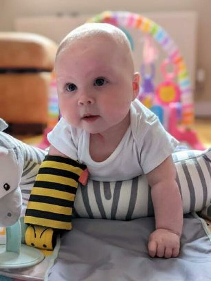 Con 18 semanas, mi hija ha recibido su primera prótesis