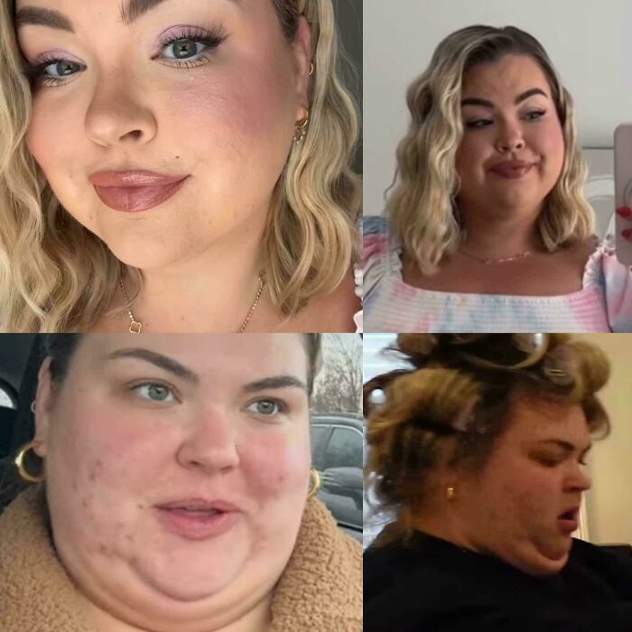 “I Never Edit My Pictures”