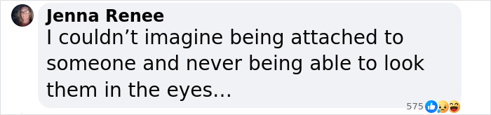 “Why Fix What Isn’t Broken?”: World’s Oldest Conjoined Twins Pass Away Aged 62 - 5