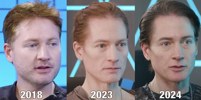 Biohacker, 46, Who Wants To Stop His Body’s Aging Process, Trolled Online After Sharing Update Biohacker, 46, Who Wants To Stop His Body’s Aging Process, Trolled Online After Sharing Update