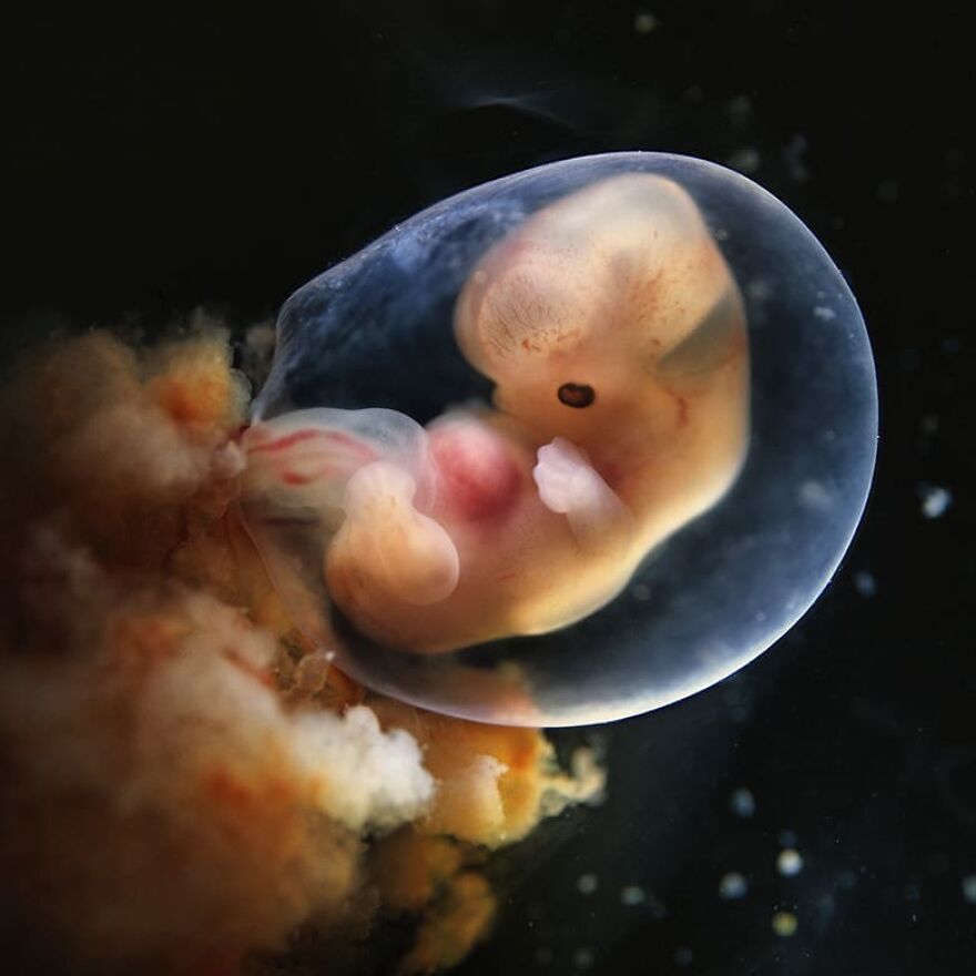 Meet Lennart Nilsson, The Photographer Who Spent 12 Years Photographing The Development Of Fetuses