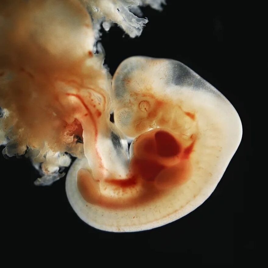 Meet Lennart Nilsson, The Photographer Who Spent 12 Years Photographing The Development Of Fetuses