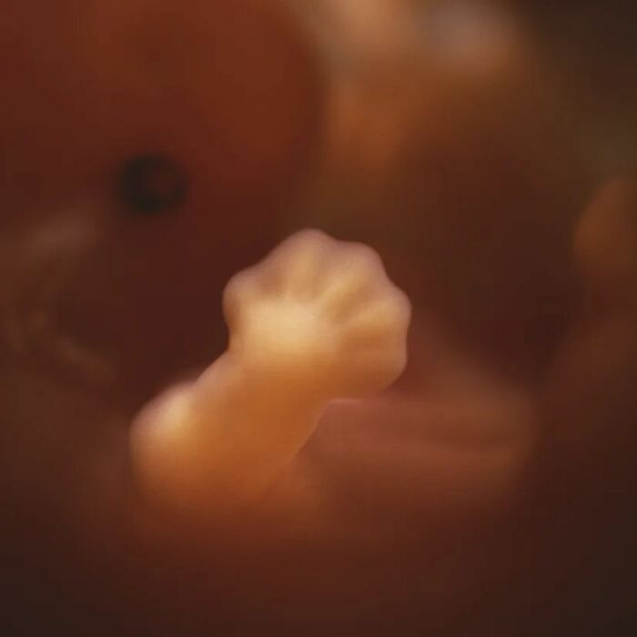 19 Groundbreaking Images By This Photographer Offering A Glimpse Into The Miracle Of Birth