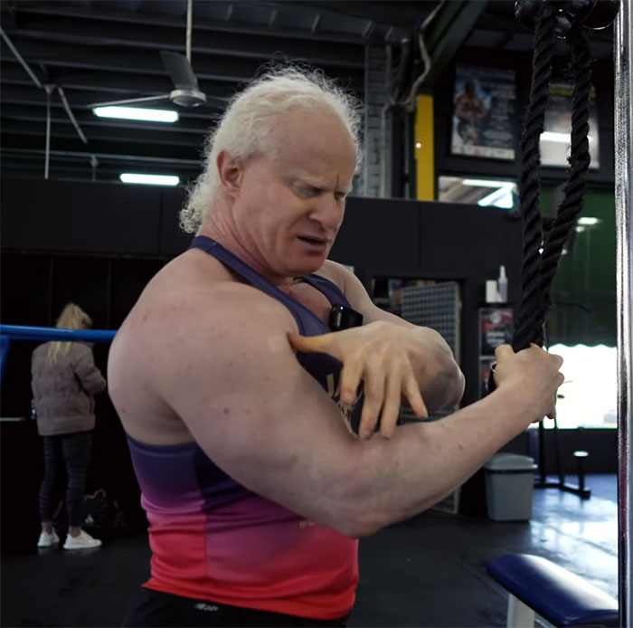 Blind, Albino Personal Trainer Shares Update After Being Forced To Quit Because Of &ldquo;Lack Of Clients&rdquo;
