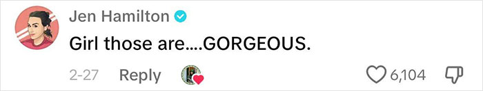 After Having All Her Teeth Pulled Out At 20, Woman Shares &ldquo;Before/After&rdquo; Implants Transformation