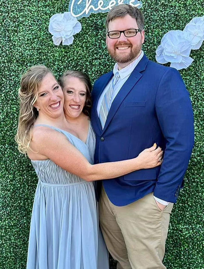 Internet Can’t Stop Talking About Abby And Brittany Hensel’s Bikini Picture After Wedding News Internet Can’t Stop Talking About Abby And Brittany Hensel’s Bikini Picture After Wedding News