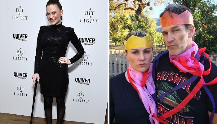 “It Hasn’t Been Easy,” Anna Paquin Says As She Returns To Red Carpet With Cane For Support