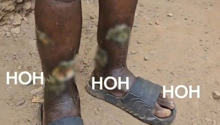 “Zombie Psychoactive” Users Begin Digging Up Graves For Ingredients, Prompting National Emergency - 4