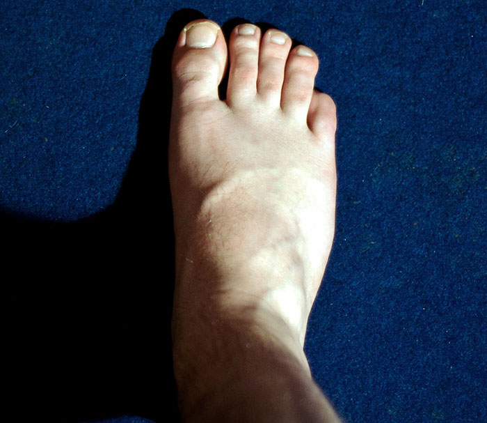 Someone Asks People To Share The Grossest Thing Their Partner Does, And 30 Don't Hold Back - 5