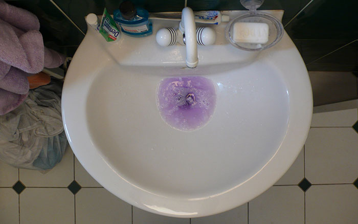 Someone Asks People To Share The Grossest Thing Their Partner Does, And 30 Don't Hold Back - 33