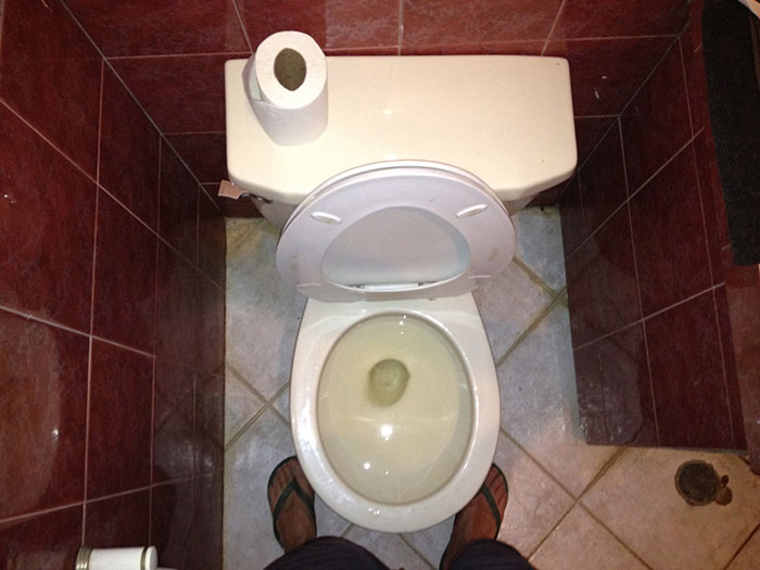 Someone Asks People To Share The Grossest Thing Their Partner Does, And 30 Don't Hold Back - 12