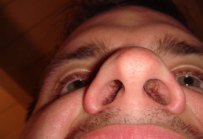 Someone Asks People To Share The Grossest Thing Their Partner Does, And 30 Don't Hold Back - 15