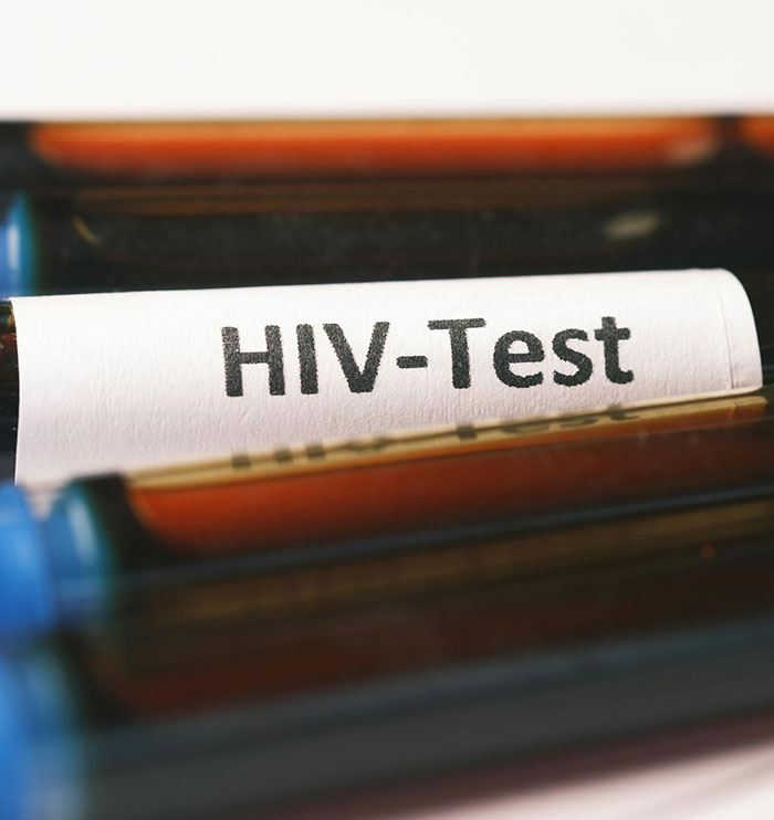 3 Women Test Positive For HIV After Getting Spa Treatment Promoted By Kim Kardashian