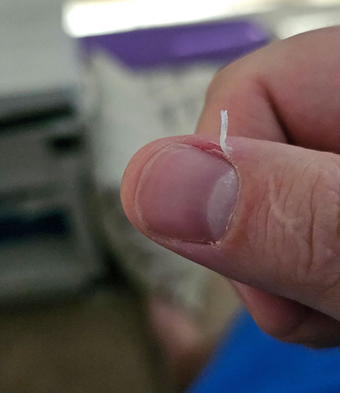 Oh, Come On. Mildly Infuriating Indeed