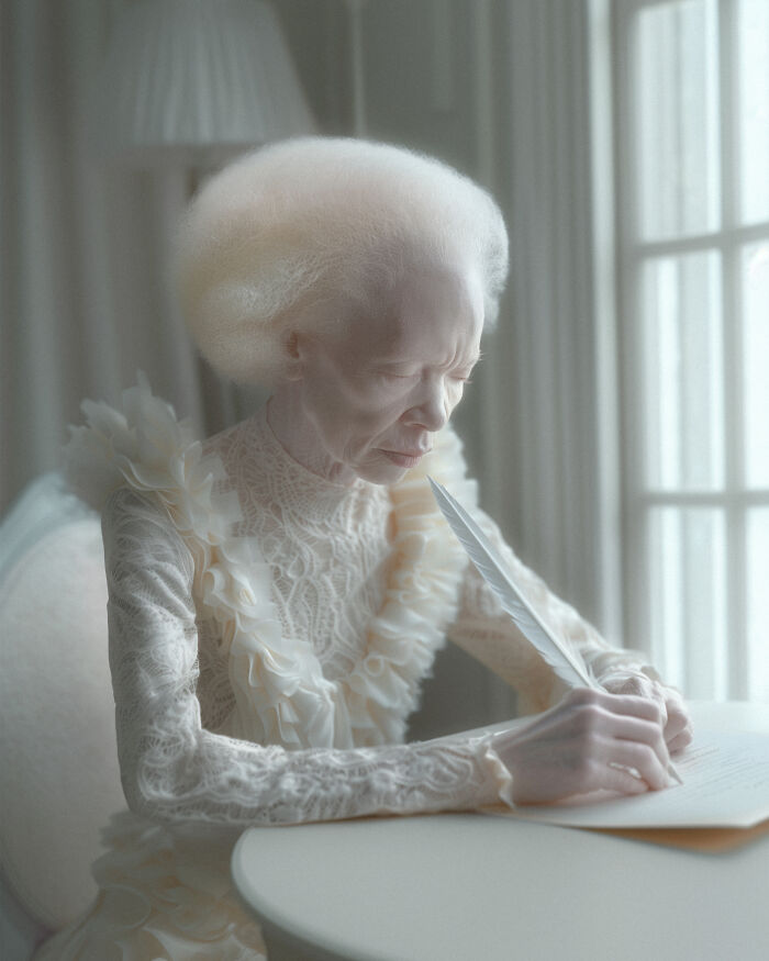 I've Created An Ai Project Dedicated To People With Albinism