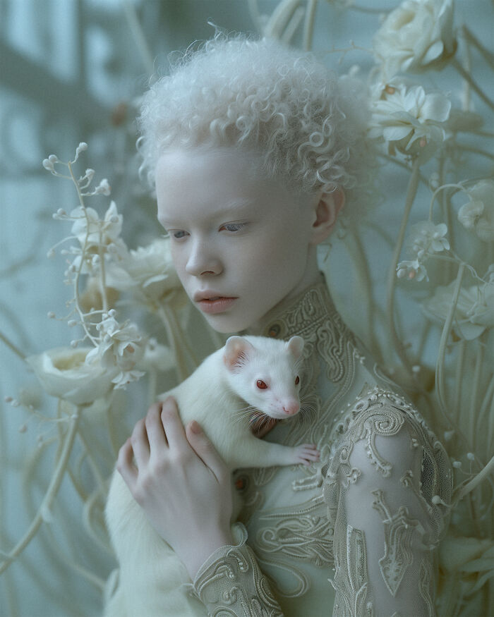 I've Created An Ai Project Dedicated To People With Albinism