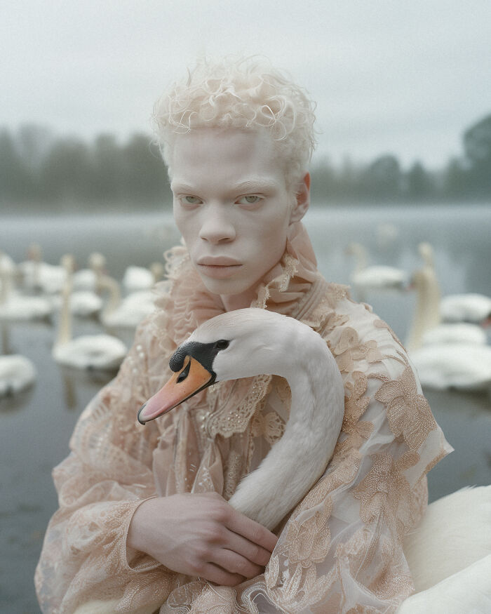 I've Created An Ai Project Dedicated To People With Albinism