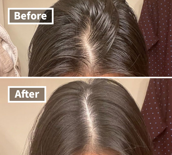 Revive Your Locks In An Instant! Just Tap I DEW CARE’s Dry Shampoo Powder And Voila!