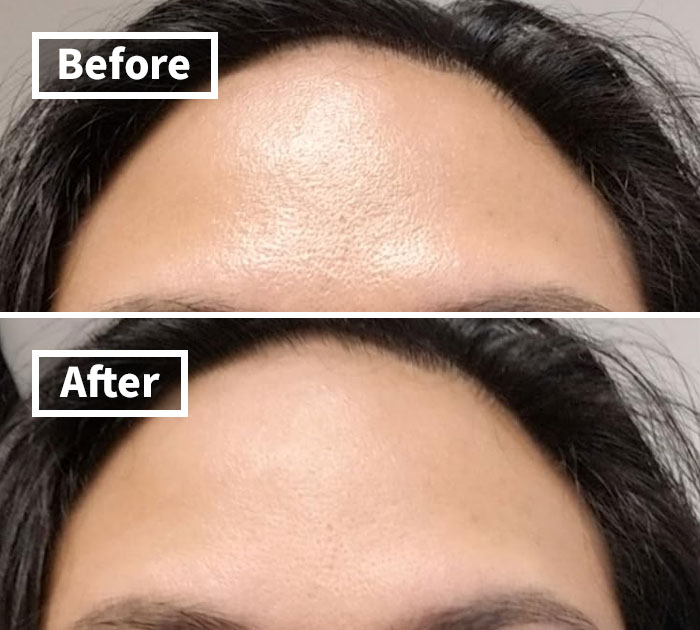 Tidy Up Your Skin Game With Revlon's Volcanic Face Roller, Your Secret Weapon For A Shine-Free Face