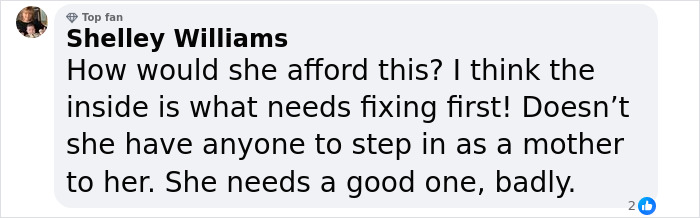 &ldquo;Who Paid For This?&ldquo;: Fans Confused By Gypsy Rose Blanchard&rsquo;s Nose Job To Look &ldquo;More Feminine&rdquo;