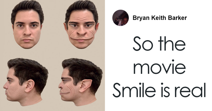 Man With Rare Disorder With Less Than 100 Reported Cases Sees People Like Demonic Figures