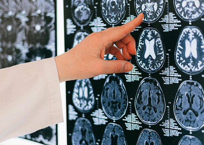 “Marking Those Papers Broke Me”: 40 Times Students Stunned Their Teachers With Their Stupidity - 18