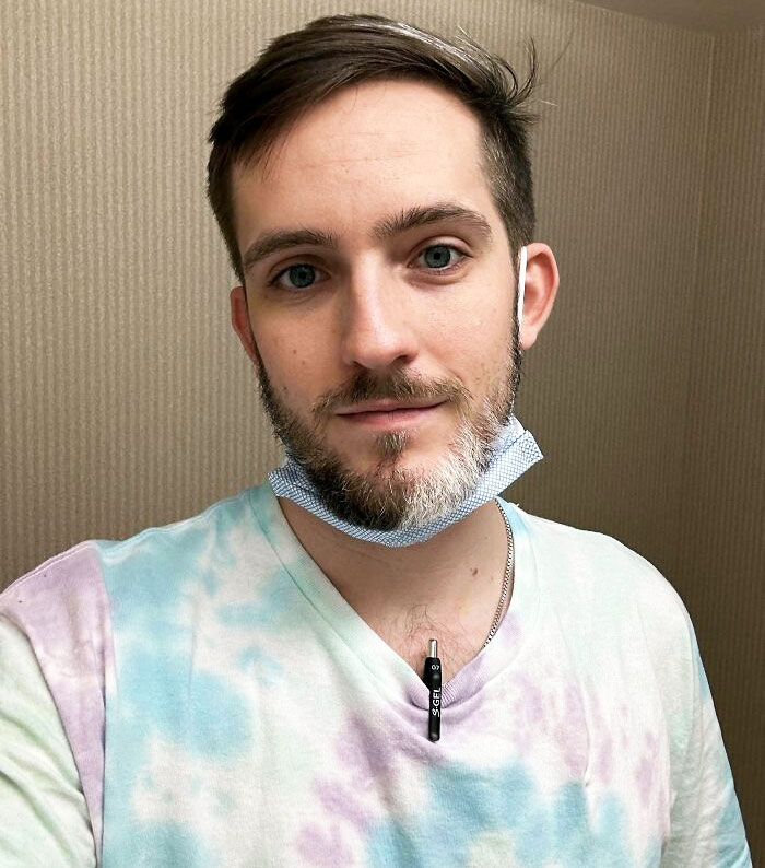 Half My Beard Grows In White