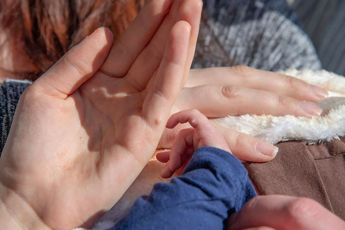 Children Born 11 Years Apart Have The Same Skin Tag In The Same Spot