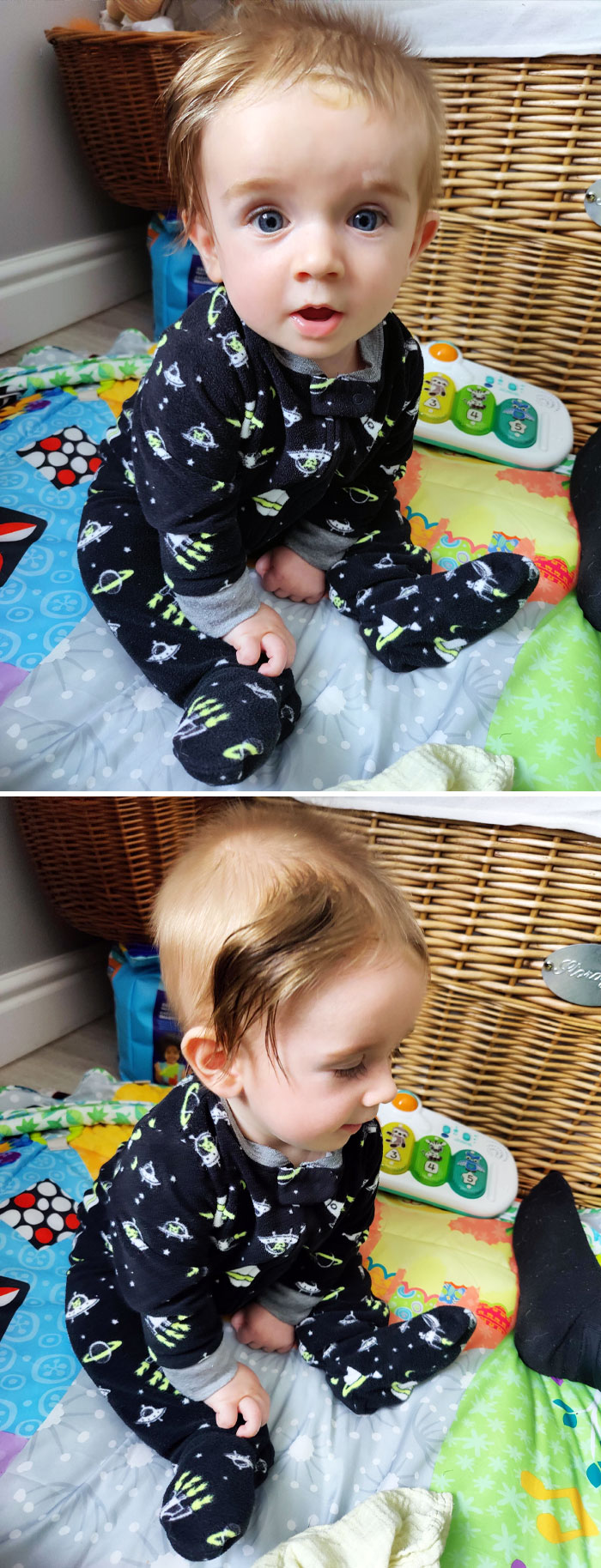 My Son's Birthmark Gives Him The Best Hairstyle
