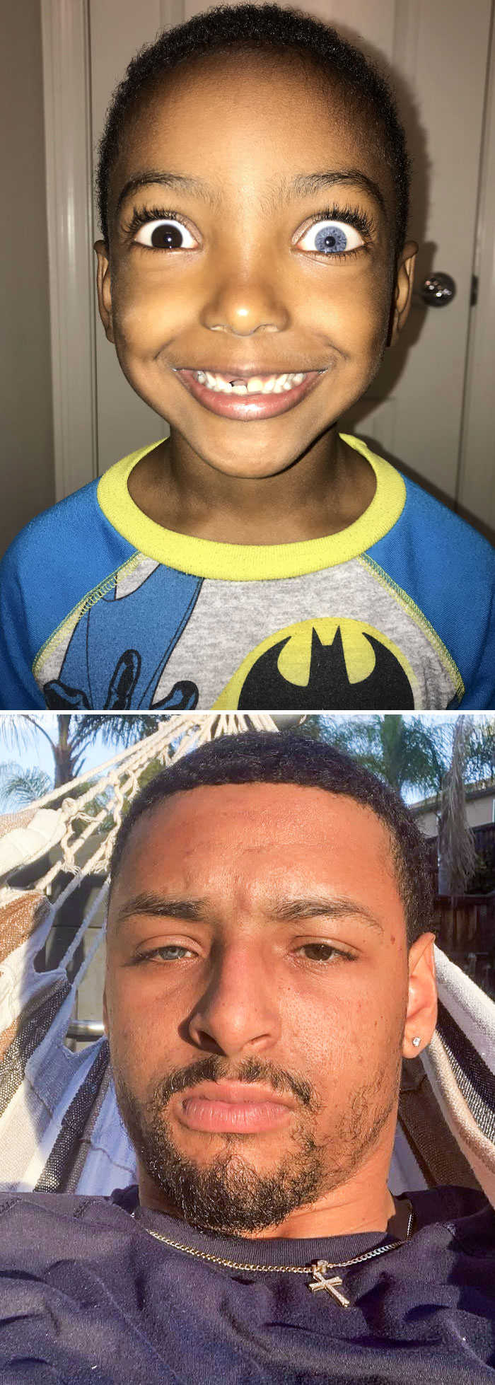 My Little Brother And Me, Both With Heterochromia