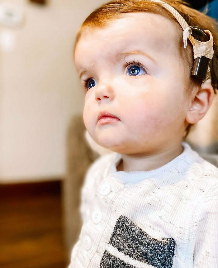 When Cooper Was About 3 Weeks Old, Waardenburg Syndrome Came Onto Our Radar For The First Time