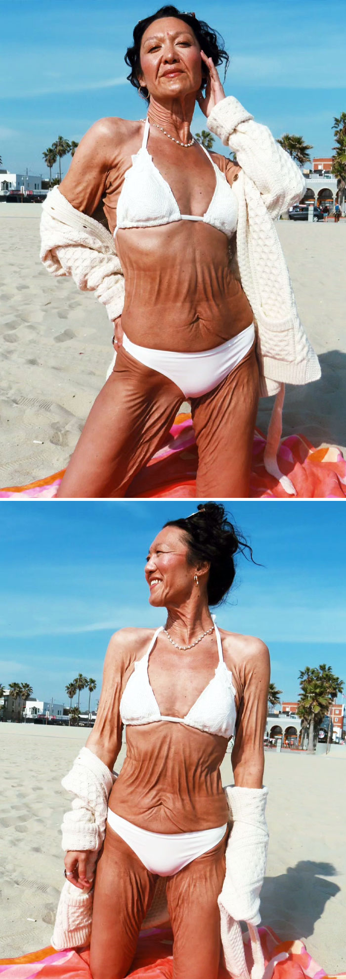 Glowing And Growing With Ehlers-Danlos Syndrome