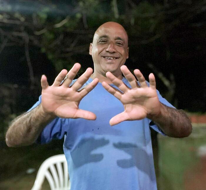 Meet Veinticuatro (24). He Has Twelve Movable Fingers And Twelve Movable Toes