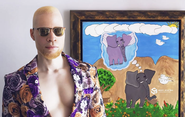 Picture For International Albinism Month