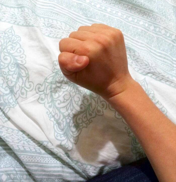 My Thumb Bends Backwards