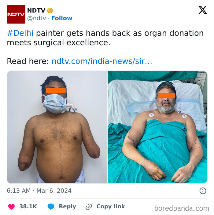 Salute To The Donor And The Doctors