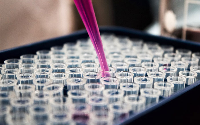 Teen Panics After DNA Results With Her Twin Sister Changed Everything She Knew About Herself