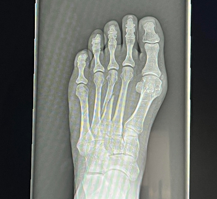 History Enthusiasts Are Sharing History Facts That Many People Would Find Shocking (50 Facts)