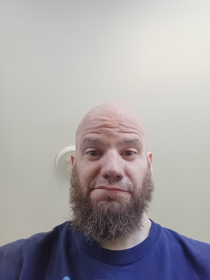 My Hair Rain Away Years Ago