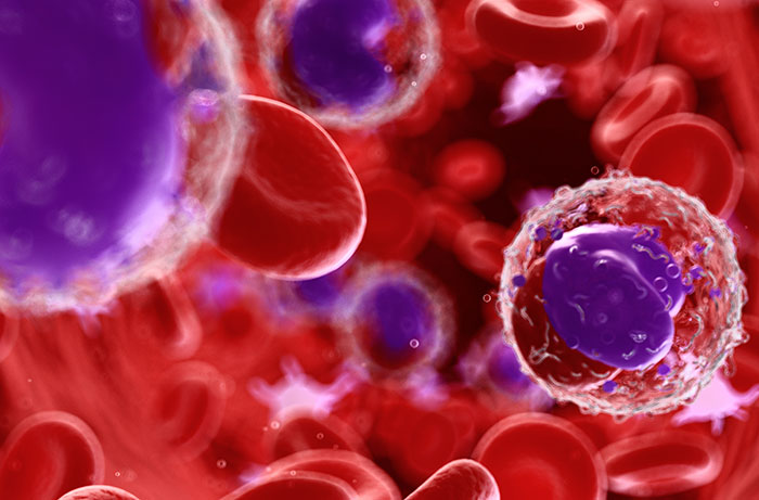 Blood cells and cancer cells under a microscope, related to lymphoma and cancer studies. Blood cells and cancer cells under a microscope, related to lymphoma and cancer studies.