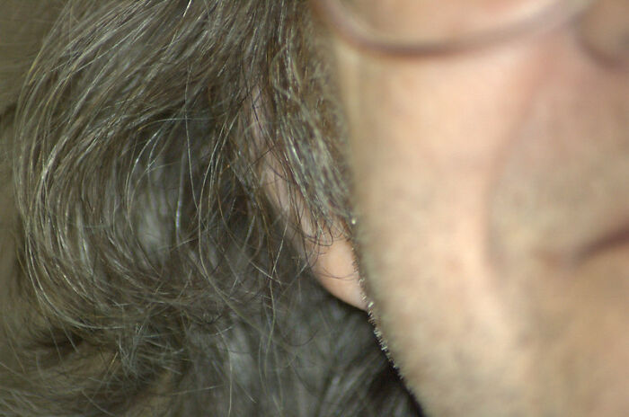 "The Check Engine Light Came On": 30 Body Changes People Experienced After Hitting 40