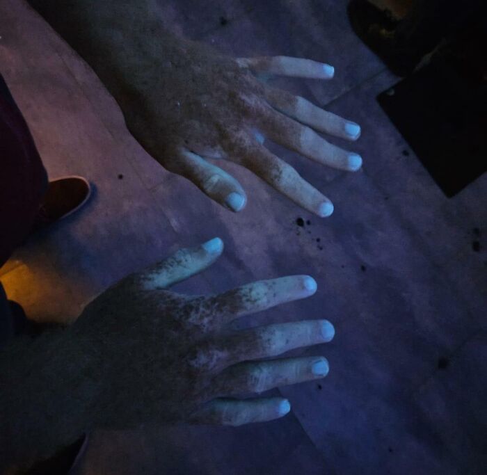 My Hands Under A UV Light