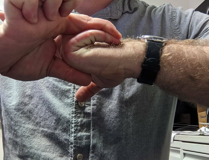 My Fingers Can Bend Way Back