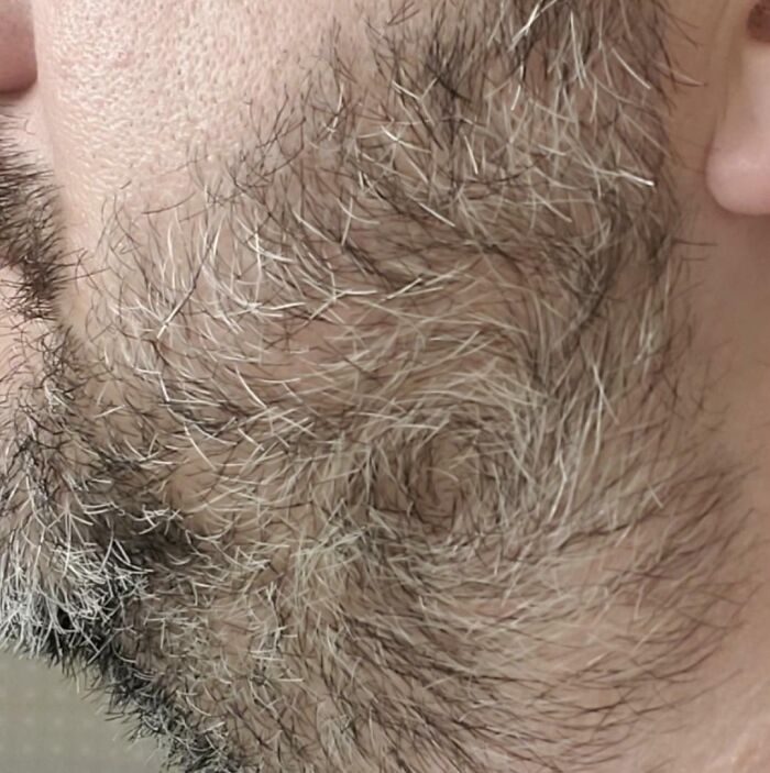 First Time Growing A Beard And Apparently I Have A Whirlpool Cowlick